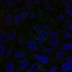 Anti-CMTM6 Antibody