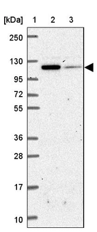 Lane 1: Marker [kDa] 250, 130, 95, 72, 55, 36, 28, 17, 10_br/_Lane 2: Human cell line RT-4_br/_Lane 3: Human cell line U-251 MG