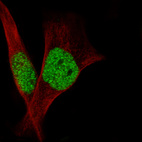 Anti-SMARCB1 Antibody