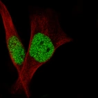 Immunofluorescence staining in RH-30 cell line with Anti-SMARCB1 monoclonal antibody, showing specific staining of nucleoplasm in green. Microtubule- and nuclear probes are visualized in red and blue respectively (where available).