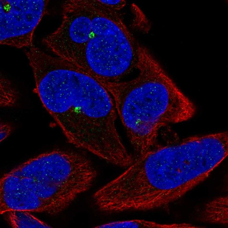 Anti-ZNF766 Antibody