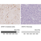 Anti-GFAP Antibody