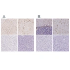 Immunohistochemical staining of human cerebellum, cerebral cortex, liver and pancreas using Anti-GFAP antibody HPA063513 (A) shows similar protein distribution across tissues to independent antibody HPA056030 (B).