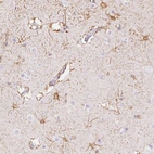 Immunohistochemical staining of human cerebral cortex shows moderate cytoplasmic positivity in Astrocytes.