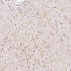 Immunohistochemical staining of human cerebellum shows strong positivity in neuronal processes in neuropil.