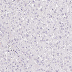 Immunohistochemical staining of human liver shows no cytoplasmic positivity in hepatocytes as expected.