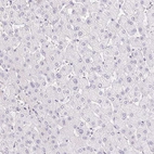 Immunohistochemical staining of human liver shows no cytoplasmic positivity in hepatocytes as expected.