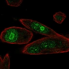 Anti-PHLDA1 Antibody