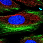 Immunofluorescent staining of human cell line HeLa shows localization to nucleoplasm & actin filaments.