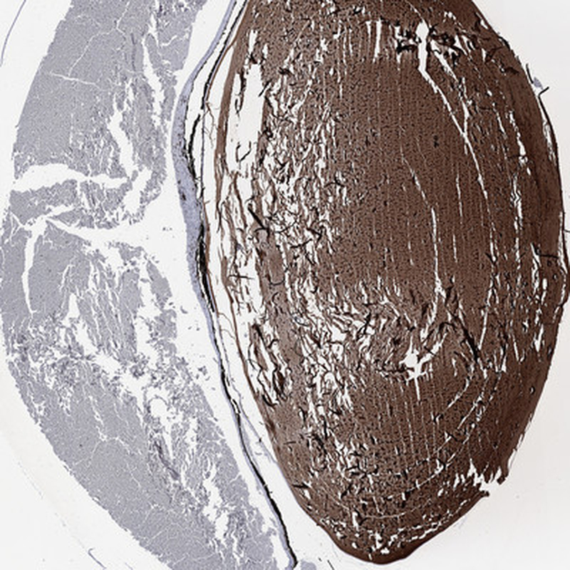 Anti-CRYGS Antibody