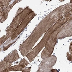 Immunohistochemical staining of human skeletal muscle shows high expression.
