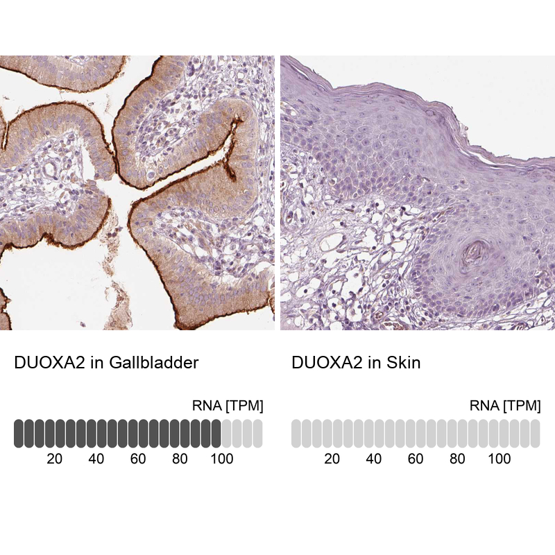 Anti-DUOXA2 Antibody