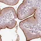 Immunohistochemical staining of human gallbladder shows strong positivity in apical membrane in glandular cells.