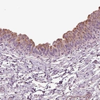 Immunohistochemical staining of human urinary bladder shows strong granular cytoplasmic positivity in urothelial cells.