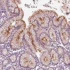 Immunohistochemical staining of human stomach shows strong positivity in apical membrane in glandular cells.