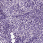 Immunohistochemical staining of human lymph node shows no positivity in non-germinal center cells as expected.
