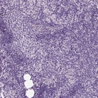 Immunohistochemical staining of human lymph node shows no positivity in non-germinal center cells as expected.