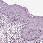 Immunohistochemical staining of human skin shows no positivity in squamous epithelial cells as expected.