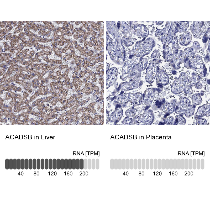Anti-ACADSB Antibody