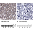 Anti-ACADSB Antibody
