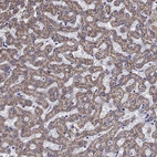 Immunohistochemical staining of human liver shows strong cytoplasmic graular positivity in hepatocytes.