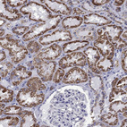 Immunohistochemical staining of human kidney shows strong cytoplasmic granular positivity in cells in tubules.