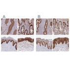 Anti-ITGA2 Antibody