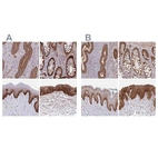 Immunohistochemical staining of human endometrium, rectum, skin and urinary bladder using Anti-ITGA2 antibody HPA063556 (A) shows similar protein distribution across tissues to independent antibody HPA060991 (B).