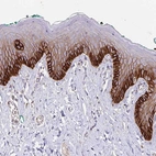 Immunohistochemical staining of human skin shows strong membranous positivity in squamous epithelial cells.
