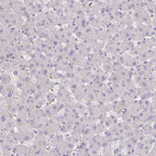 Anti-ITGA2 Antibody