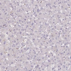 Immunohistochemical staining of human liver shows no positivity in hepatocytes as expected.