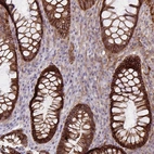 Immunohistochemical staining of human rectum shows moderate to strong membranous positivity in glandular cells.