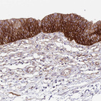 Immunohistochemical staining of human urinary bladder shows moderate to strong membranous positivity in urothelial cells.