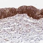 Immunohistochemical staining of human urinary bladder shows moderate to strong membranous positivity in urothelial cells.