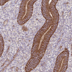 Anti-ITGA2 Antibody