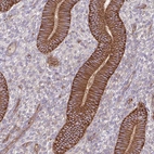 Immunohistochemical staining of human endometrium shows moderate to strong membranous positivity in glandular cells.