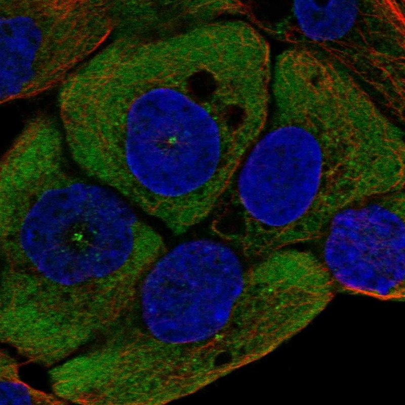 Anti-WNT11 Antibody