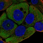Anti-WNT11 Antibody