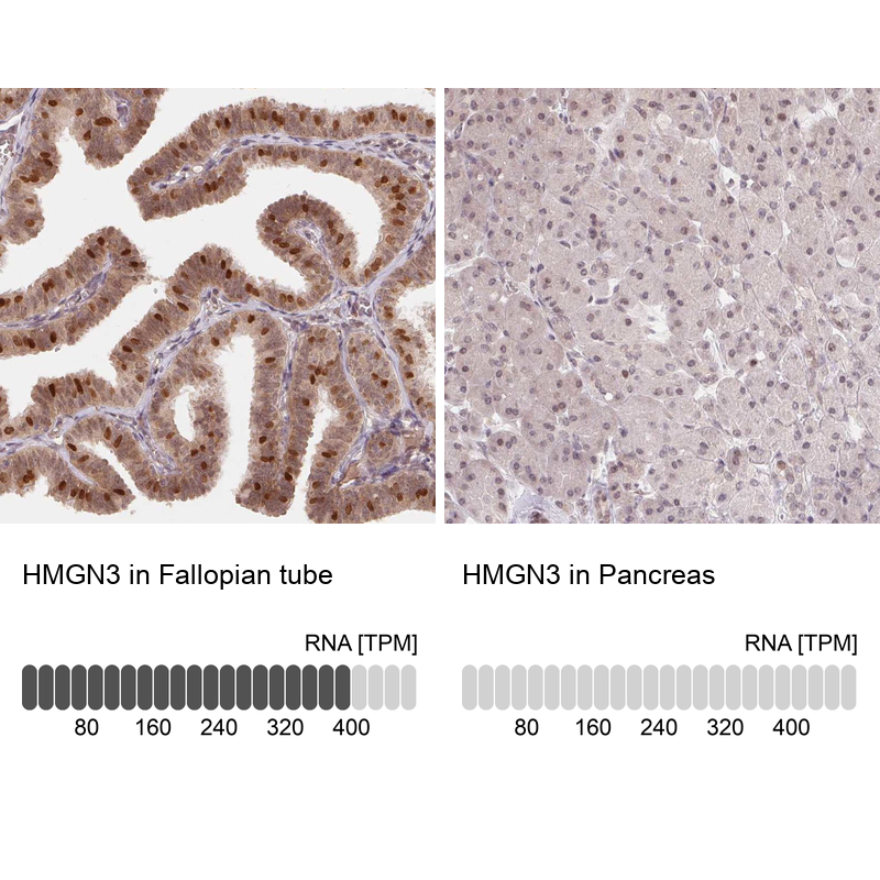 Anti-HMGN3 Antibody