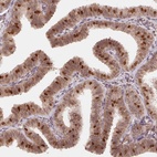 Anti-HMGN3 Antibody