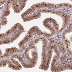 Immunohistochemical staining of human fallopian tube shows high expression.