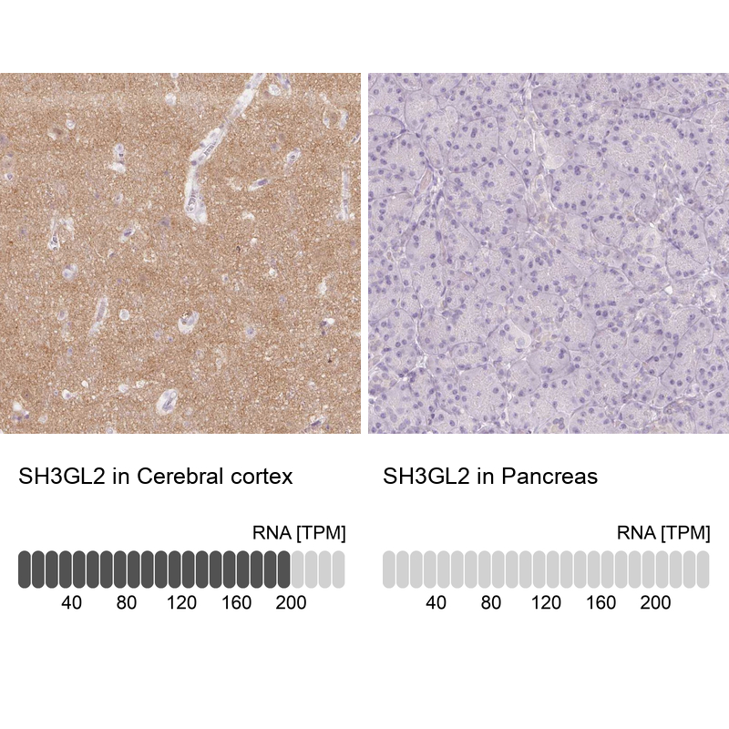 Anti-SH3GL2 Antibody