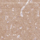 Immunohistochemical staining of human cerebral cortex shows high expression.