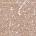 Immunohistochemical staining of human cerebral cortex shows high expression.
