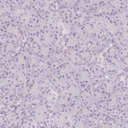 Immunohistochemical staining of human pancreas shows low expression as expected.