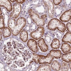 Anti-VSTM5 Antibody