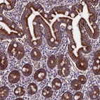 Anti-AEBP1 Antibody