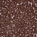 Immunohistochemical staining of human liver shows strong granular cytoplasmic positivity in hepatocytes.
