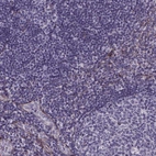 Immunohistochemical staining of human tonsil shows no positivity in non-germinal center cells as expected.