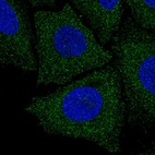 Anti-LIX1L Antibody